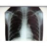 Buy cheap Hospital Clear Medical X-Ray Film Konida With Thermal Printers from wholesalers