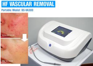 Quality Painless 30MHz High Frequency Skin Care Machine For Spider Vein Treatment wholesale
