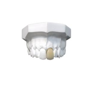 Quality Good Biocompatibility Porcelain Dental Crown High Tech Biological Material wholesale