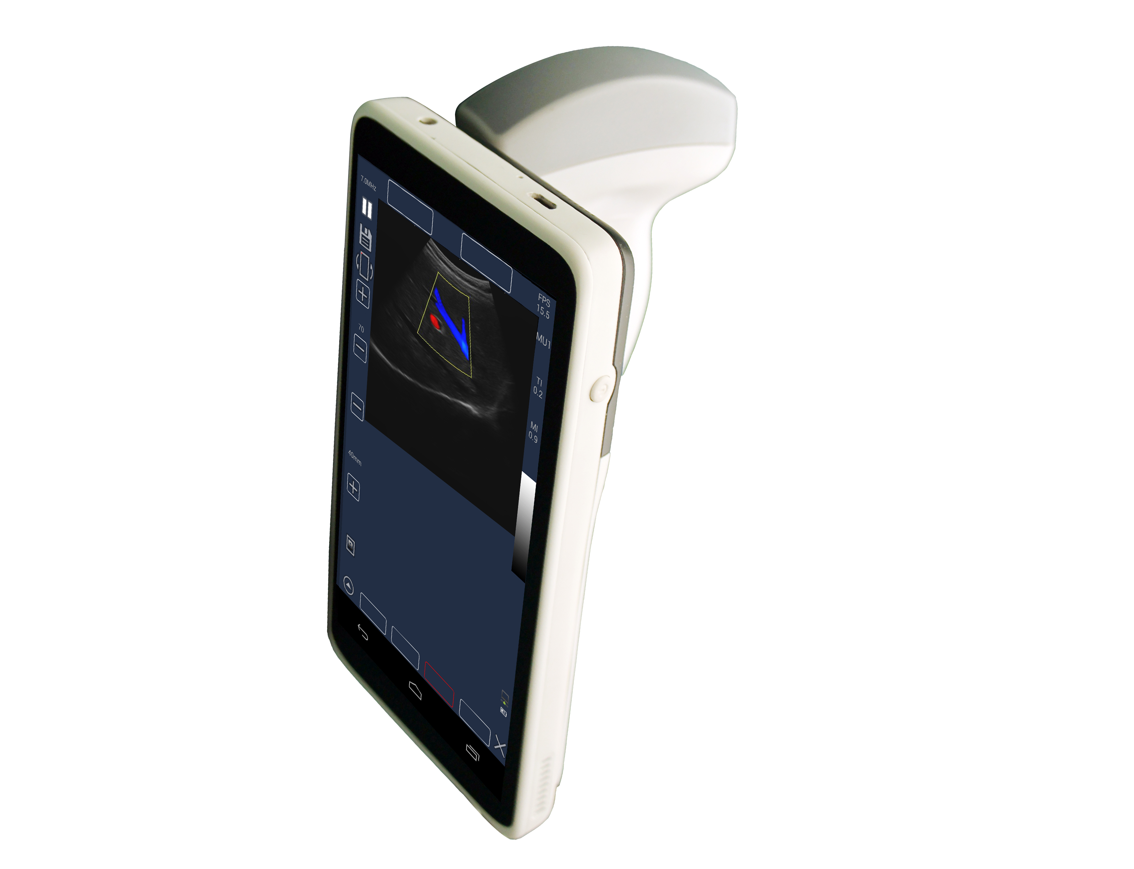 Ultrasound Scanner 6 inch 128 Elements Handheld Touch Screen Color Doppler Machine with convex/linear probe
