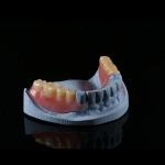 Lightweight Flexible Valplast Partial Denture For Single Tooth