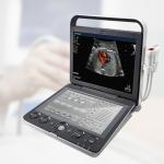 Sonoscape S9 Pregnant Baby Medical Diagnosis 4D Color Doppler Sonography Machine