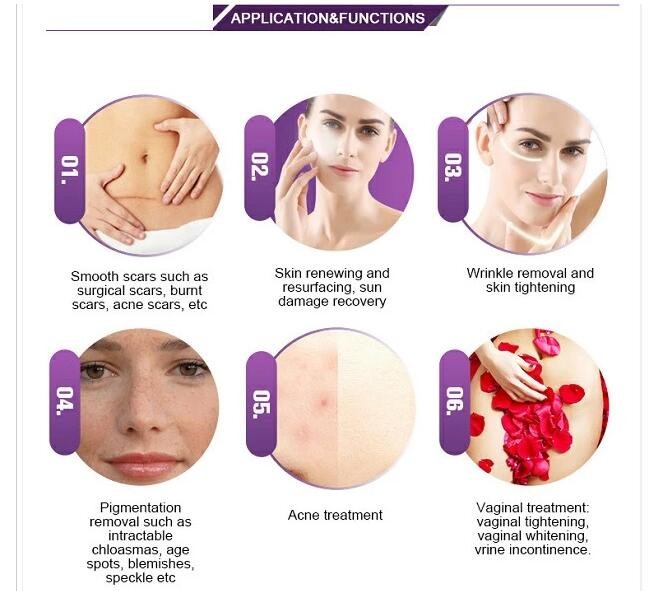 Medical Fractional Laser Beauty Machine System Control 10600nm Wavelength fractional co2 laser