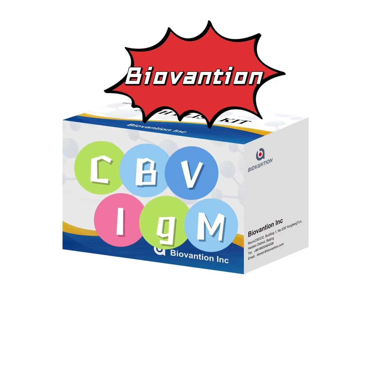 Diagnostic Kit For IgM Antibody To CBV Elisa Test Kit 50μL Serum Medical Diagnosis
