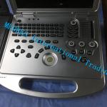 Portable Ultrasound Machine Doppler Ultrasonic Diagnostic E2 Sonoscape Price