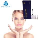 Hyaluronic Acid Dermal Filler For Lips Fullness , 1ml HA Lip Augmentation