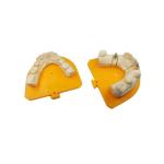 High Strength Yellow Gold Porcelain Dental Crown PFM Ceramic Crown