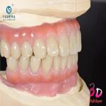 Lab Teeth Gems Dental Zirconia Block Bridge Tooth Zirconia Block