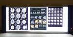 Fuji / Agfa X Ray Film , 8in x 10in Medical Dry Termal Printer Film