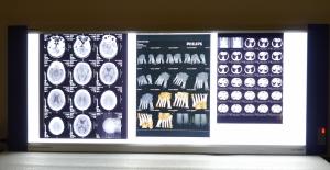 Quality 10in * 14in Digital x-ray Dry Medical Imaging Films For Thermal Printers KND-F wholesale