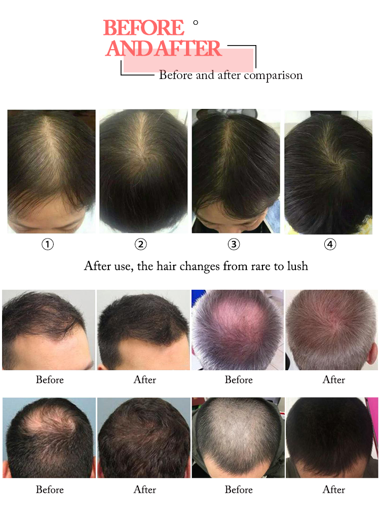 Red Diode Laser High Frequency Beauty Therapy Machine 650NM For Hair Growth OEM