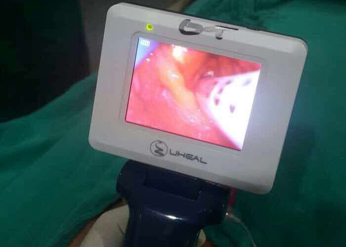 Anti Fog Single Use Laryngoscope , Disposable Video Laryngoscope With LED Cold Light
