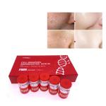 Anti Aging Skin Booster PDRN Baby Needle Injectable Mesotherapy