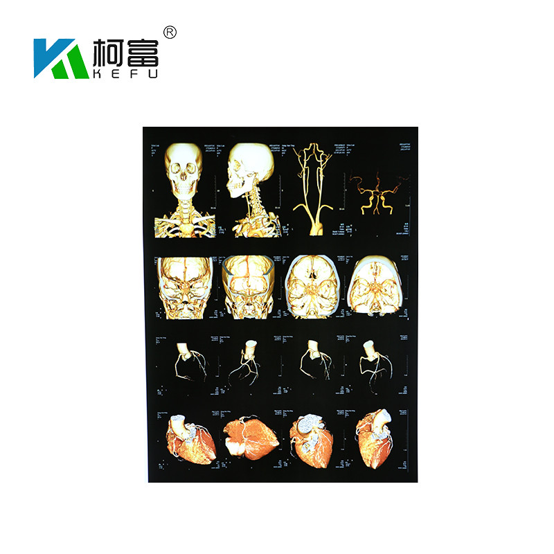 210mmx297mm Waterproof Laser X Ray Film 150 Microns OKI Xerox Fuji Printer Film