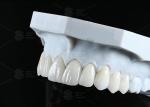 Translucency CAD EMAX Veneer Polished Glazed Ceramic Restorations For Anterior