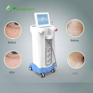 Quality 980nm Diode Laser Spider Vein Removal Machine For Blood Spider clearance wholesale