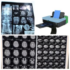 Quality 10inch Inkjet Color X Ray Film For Medical Imaging 210 Microns wholesale