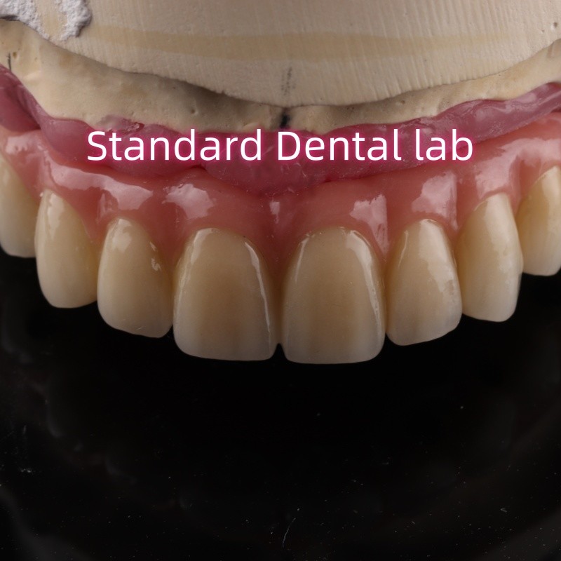 Zirconia Implant Bridge Screw Retained With Pink Gum Porcelain