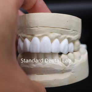 Quality Dental crowns diagnostic wax-up High Esthetics From China Dental Lab wholesale