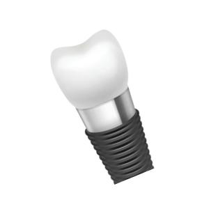 Quality Dental Implant Bars: Unparalleled Strength And Stability wholesale