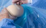 Sterilized Surgical Knee Arthroscopy Pack Medical Disposable For Hospital