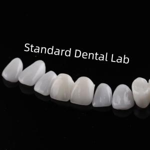 Quality High Esthetic Teeth Emax Laminate Veneers Incisal Translucency wholesale