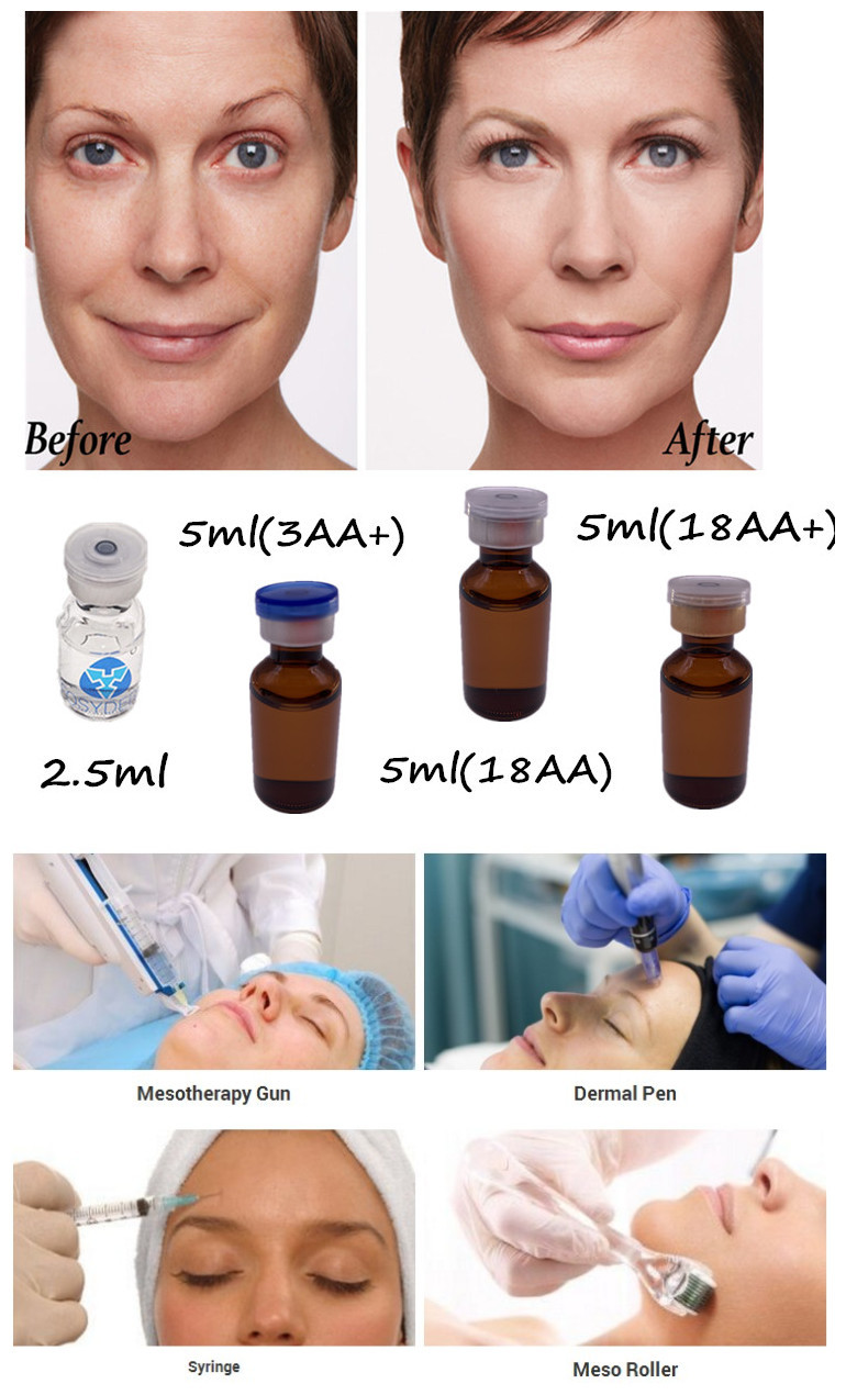 2.5ml 5ml Mesotherapy Solutions Non Crosslinked Hyaluronic Acid Meso Serum