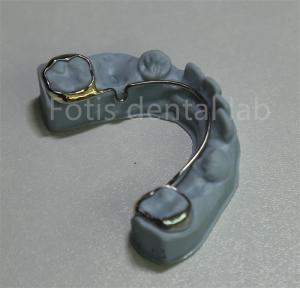 Quality China Dental Lab Orthodontic Retainer For Teeth Expansion wholesale
