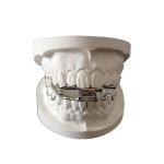 OEM Dental Orthodontic Appliances High Strength 3D Digital Design