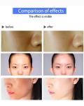 Portable Plasma Hot And Cold Therapy Beauty Instrument Beauty Plasma Pen Eyelid