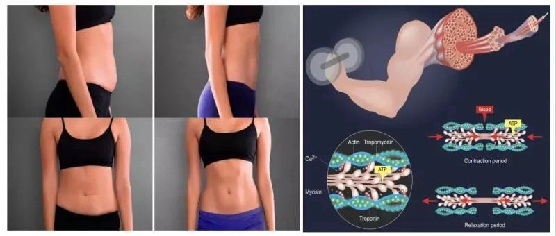 Waterproof RF EMS Muscle Stimulator Machine , ABS EMS Fat Burning Machine