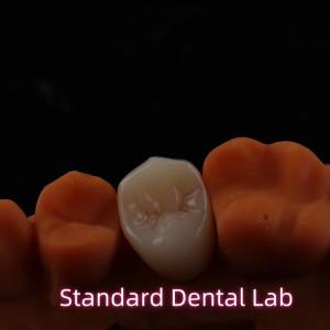 Quality High Esthetic BruxZir Full Contour Zirconia Crowns PFZ Bridge wholesale