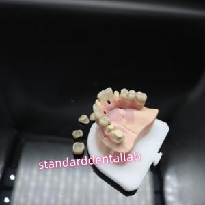 Quality Digital Dental Malo Implant Bridge Titanium Ivoclar Hybrid Zirconia Bridge wholesale