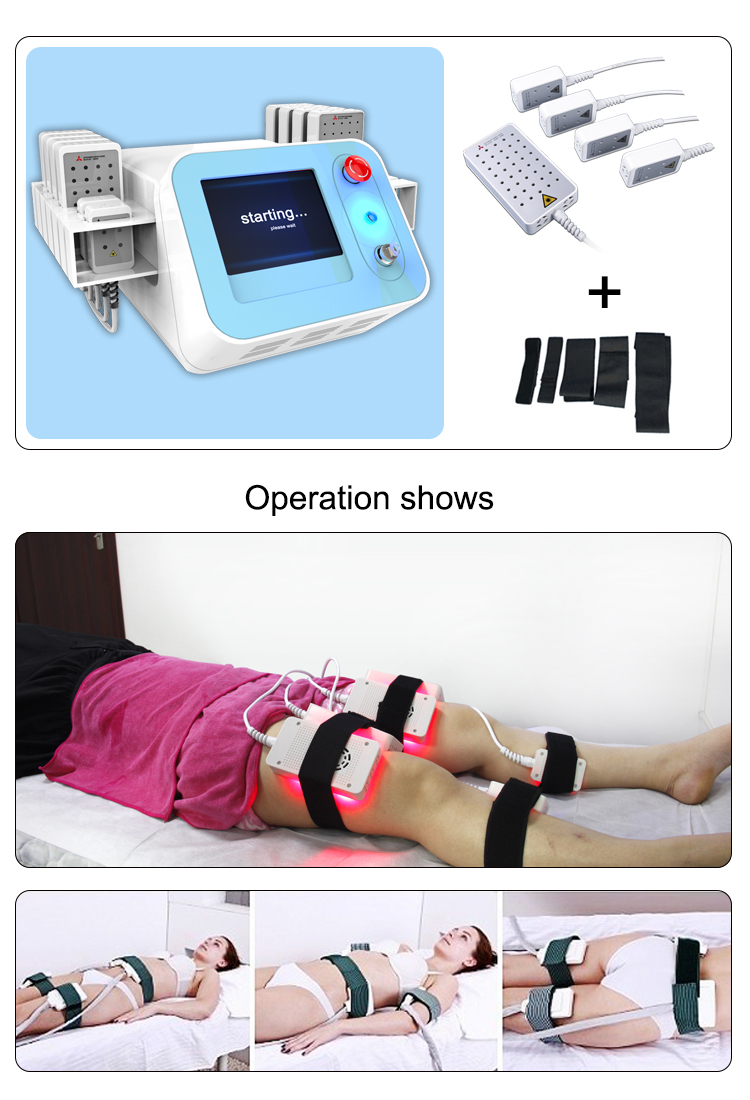 Commercial Portable Weight Loss Lipo Laser Therapy Machine 336 Diode Wavelength