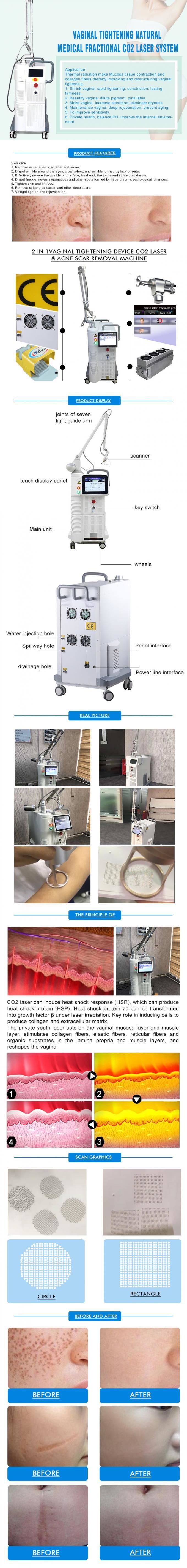 Air Cooled 40 Watts Fractional CO2 Laser Device For Skin Rejuvenation