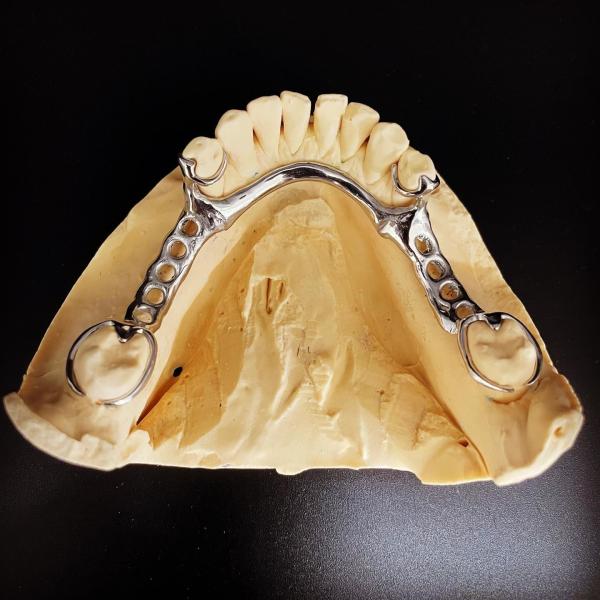 Fast and Cast Framework Co-Cr Metal Partial Denture Framework for Dental