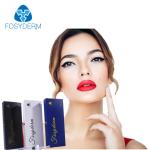 Sexy Lip Augmentation Hyaluronic Acid Dermal Filler No Side Effect Lip Filler