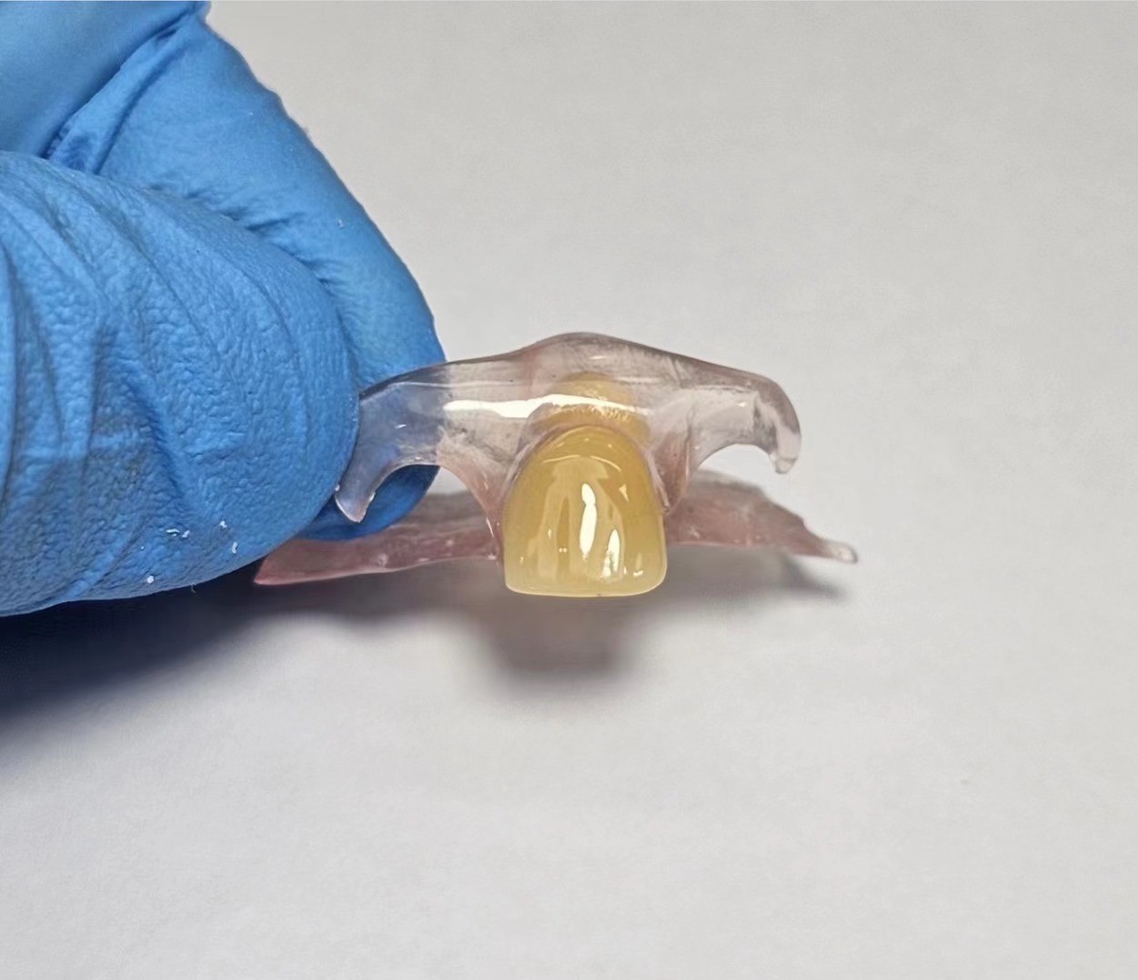 Dental TCS Valplast Flexible Partial Dentures Staining Fading Odors Resistant