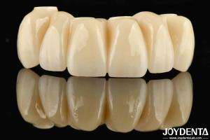 Quality Dental Restoration Ti-Base Zirconia Hybrid Bridge Natural Looking Precise Fit wholesale