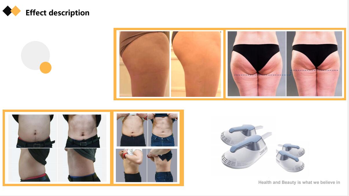 Weight Loss EMS Slim Machine 4000W Electromagnetic Body Slimming EMS Sculpting Machine