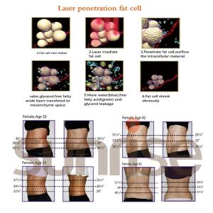 Quality Beijing sunrise CE No Pain Diode Lipo Laser / Lipolaser Fat Removal treatment wholesale