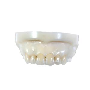 Quality Zirconia All-Ceramic Teeth Crowns &amp; Bridges wholesale