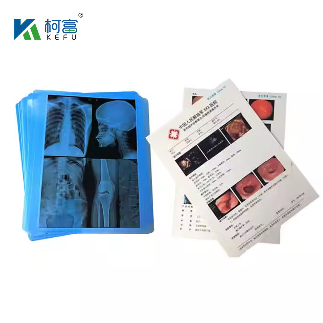 High Contrast Laser Film Inkjet Medical Film Blue PET X-Ray Film For Inkjet And Laser Printers