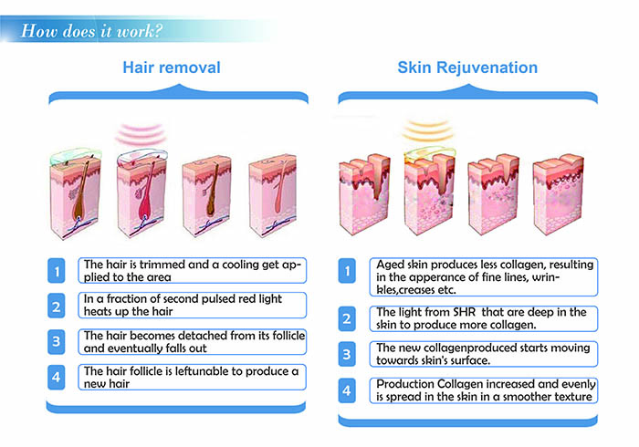 Elight SHR IPL Laser Hair Removal Machine With CE