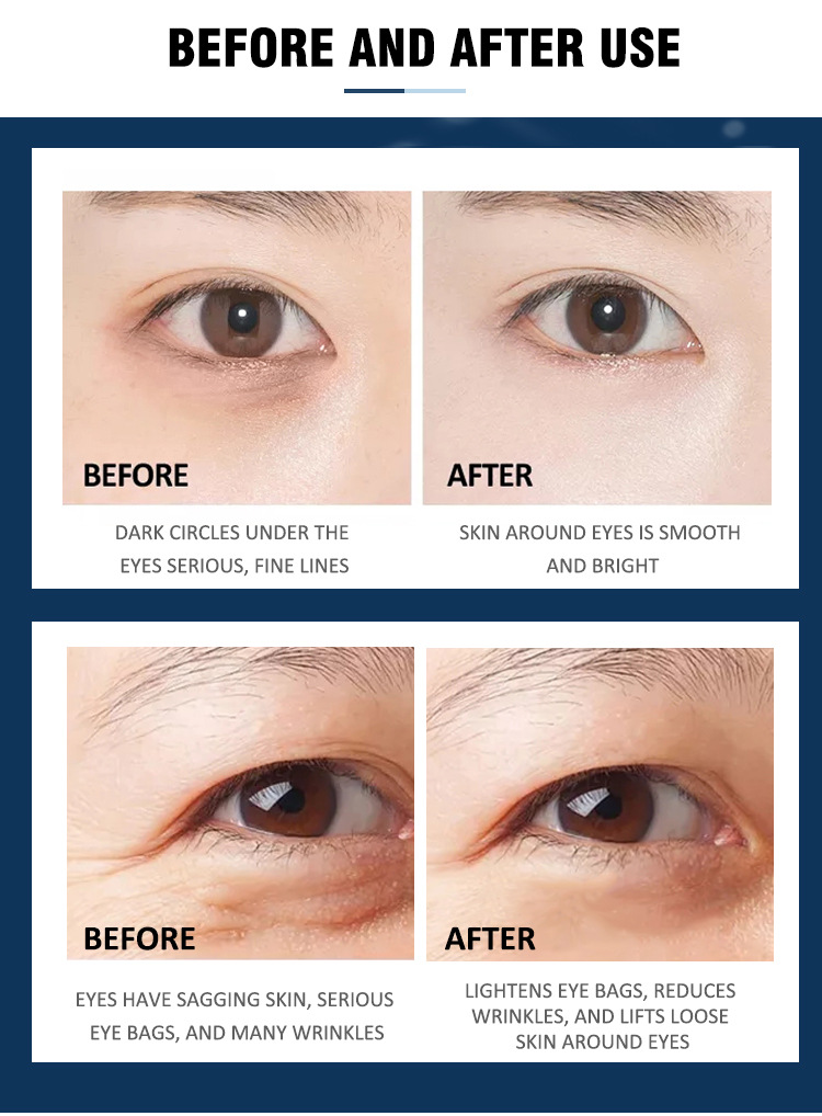 eyecream