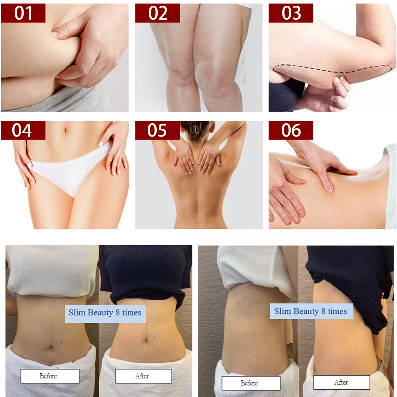 DM19-2 RF 80k Vacuum Cavitation Machine Body Slimming Cellulite Reduction