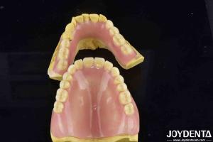 Quality Natural Tooth Morphology Flexible Denture Dental Finish For Comfortable Secure Fit wholesale