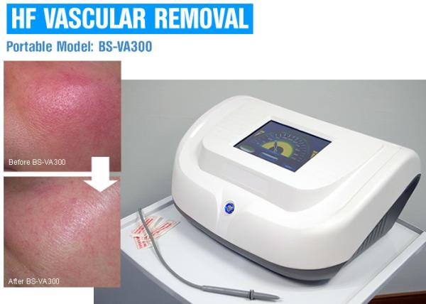 High Frequency Vascular / Spider Vein Removal Machine , Laser Varicose Vein