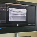 Repair ATL Affiniti50 Affiniti70 Original Acquisition Module ACQ 4535161610416