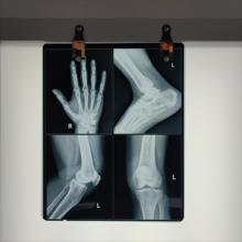 Quality Low Fog Level Medical X Ray Blue Film 200±5μM High Sharpness wholesale